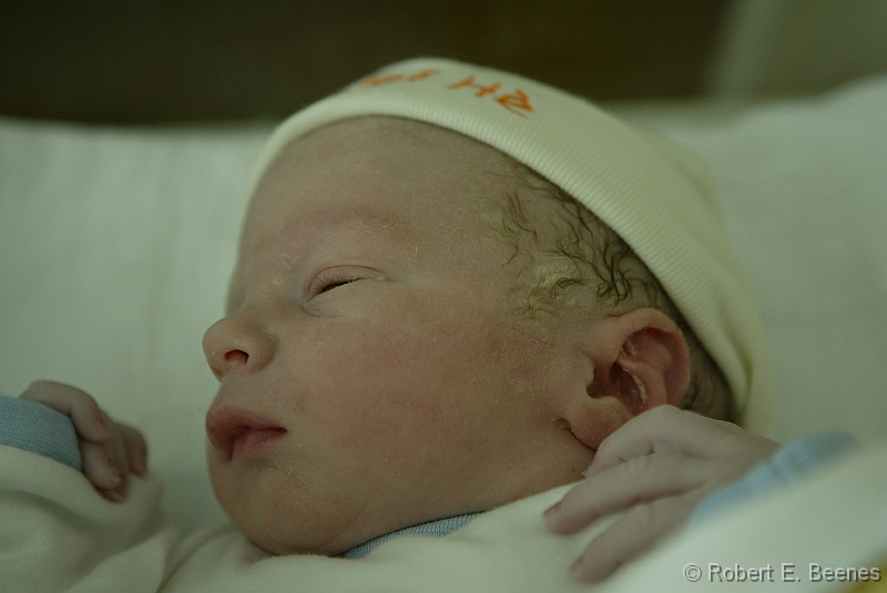 24